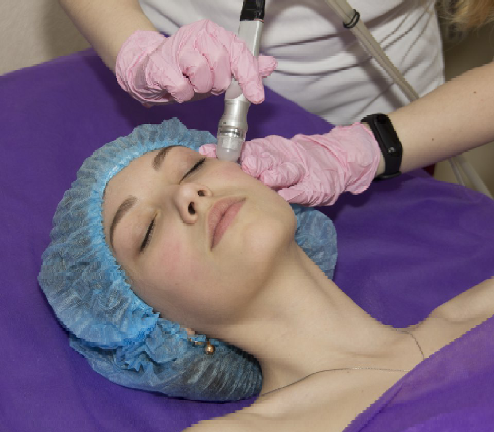 МІКРОШЛІФОВКА ОБЛИЧЧЯ